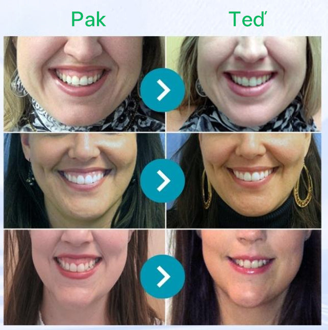 Furzero® Focusmile prášek s včelím jedem k perorálnímu užití 💋