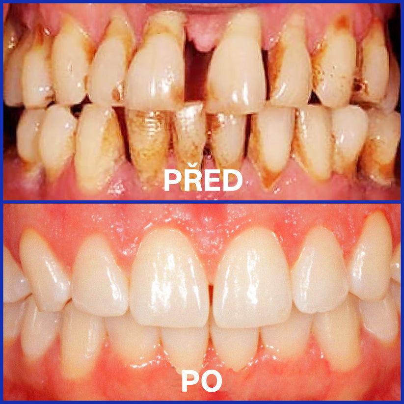 Furzero® Focusmile prášek s včelím jedem k perorálnímu užití 💋