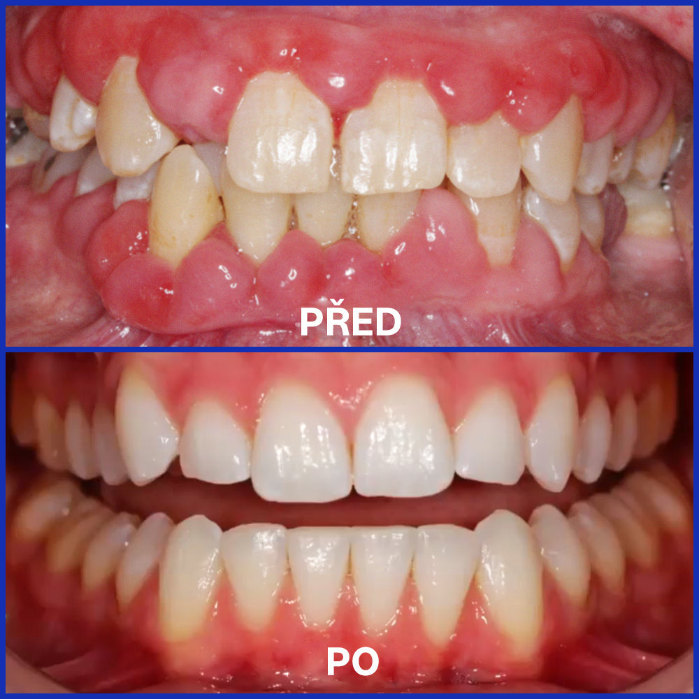 Furzero® Focusmile prášek s včelím jedem k perorálnímu užití 💋