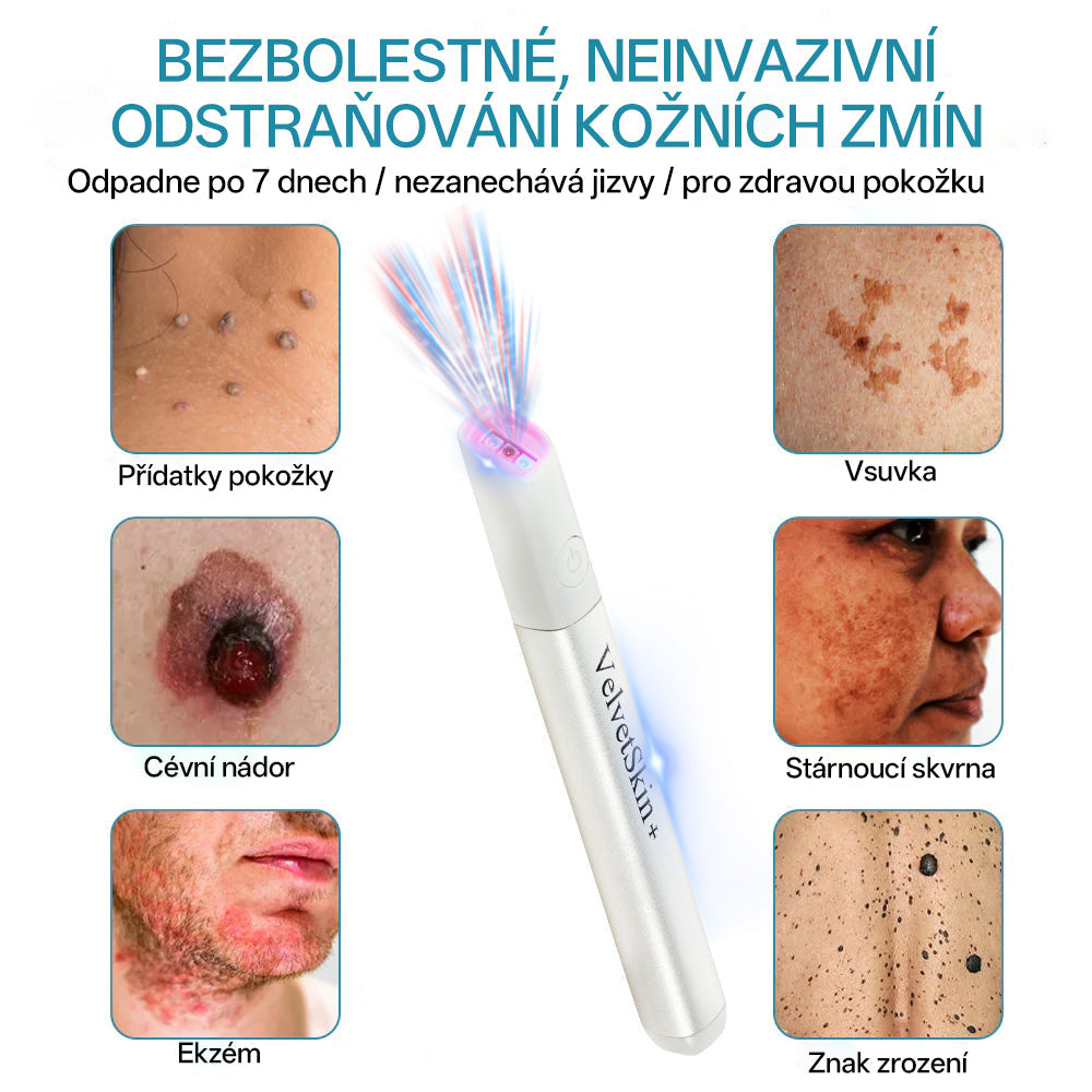 ✨ Bikenda® – CO₂ laserové pero na odstraňování 🟤 mateřských znamének, 🦠 bradavic, 🔘 skvrn a jiných nedokonalostí pleti