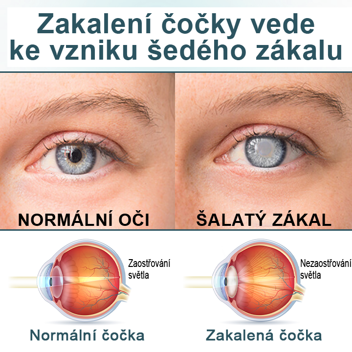 Oční kapky Timilk® optifusion nano sérum – nanotechnologie obnovuje jasný zrak, bez brýlí, bez chirurgického zákroku♥️