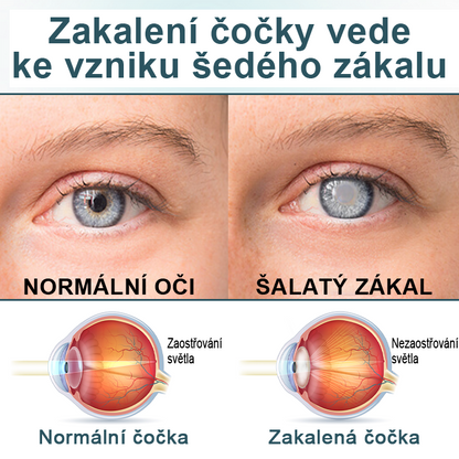 Oční kapky Timilk® optifusion nano sérum – nanotechnologie obnovuje jasný zrak, bez brýlí, bez chirurgického zákroku♥️