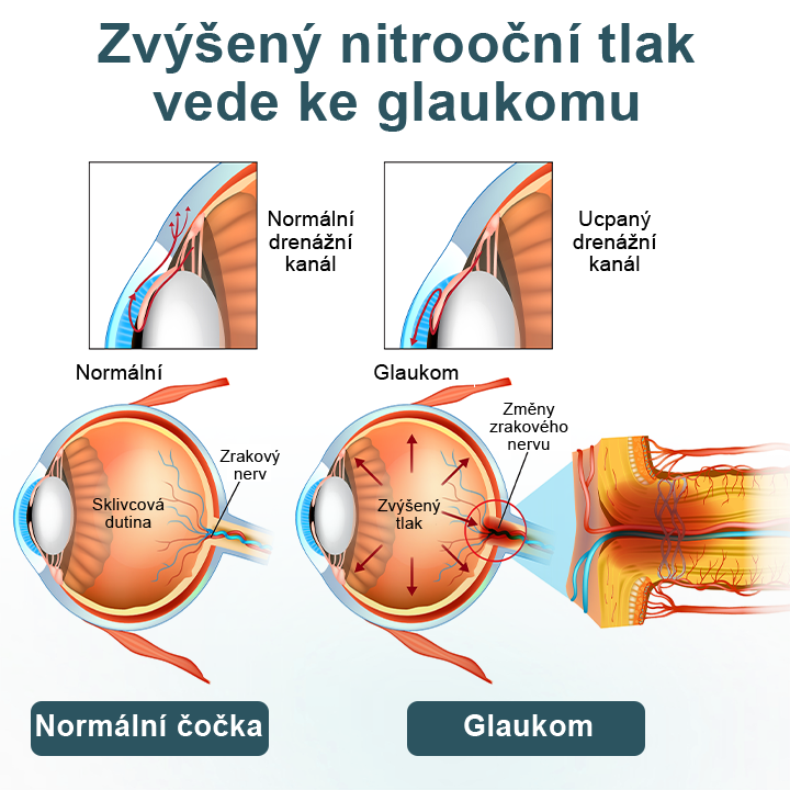 Oční kapky Timilk® optifusion nano sérum – nanotechnologie obnovuje jasný zrak, bez brýlí, bez chirurgického zákroku♥️