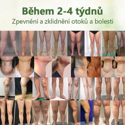 Bylinný lymfatický detoxikační krém Cvreoz®