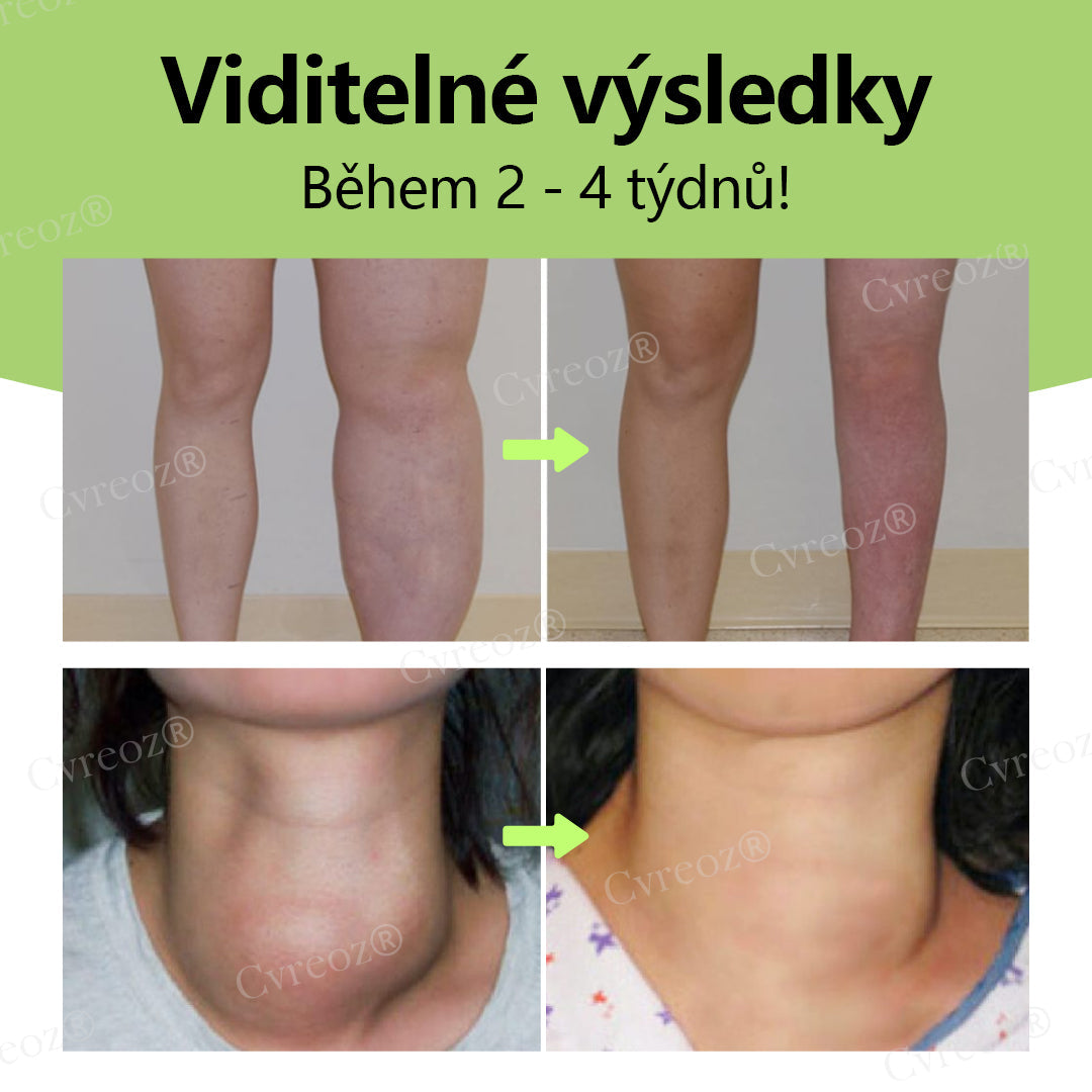 Bylinný lymfatický detoxikační krém Cvreoz®