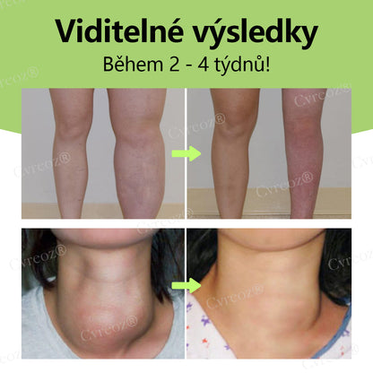 Bylinný lymfatický detoxikační krém Cvreoz®