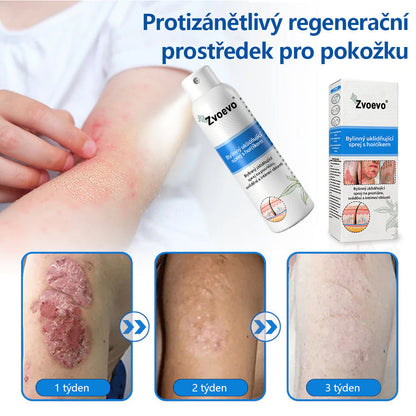 【Oficiální značkový obchod】✅Zvoevo® Magnesium bylinný sprej ⚕️ Certifikace MHRA – úleva při psoriáze, ekzému, intimních bakteriálních infekcích, akné a tmavých skvrnách