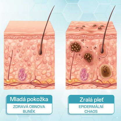 ✨ Bikenda® – CO₂ laserové pero na odstraňování 🟤 mateřských znamének, 🦠 bradavic, 🔘 skvrn a jiných nedokonalostí pleti🩸