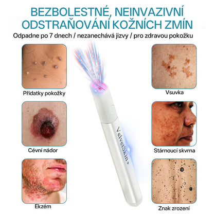✨ Bikenda® – CO₂ laserové pero na odstraňování 🟤 mateřských znamének, 🦠 bradavic, 🔘 skvrn a jiných nedokonalostí pleti🩸