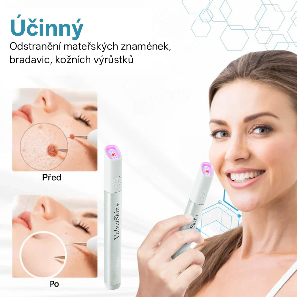 ✨ Bikenda® – CO₂ laserové pero na odstraňování 🟤 mateřských znamének, 🦠 bradavic, 🔘 skvrn a jiných nedokonalostí pleti🩸