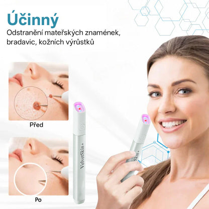 ✨ Bikenda® – CO₂ laserové pero na odstraňování 🟤 mateřských znamének, 🦠 bradavic, 🔘 skvrn a jiných nedokonalostí pleti🩸